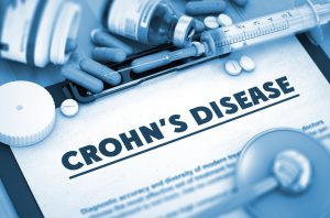 Questions to ask your nutritionist when diagnosed with Crohn's disease