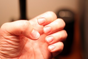 Nails-are-brittle.jpg
