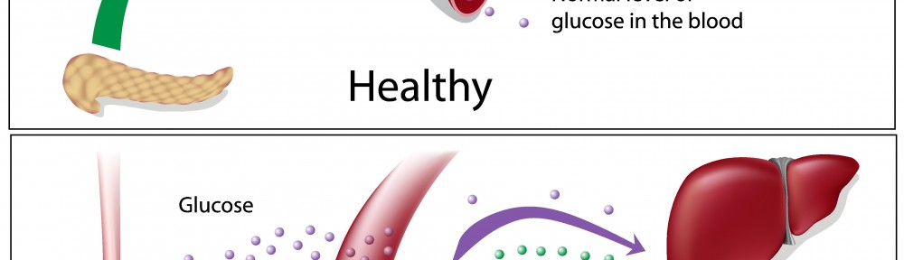 cure type 2 diabetes