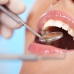 Simple Habits that Can Avoid Damage to Your Teeth
