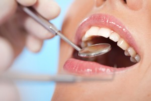Damage to Your Teeth