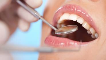 Simple Habits that Can Avoid Damage to Your Teeth
