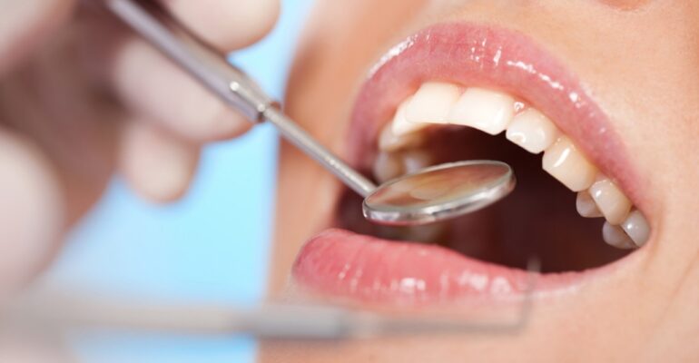 regular dental checkup​