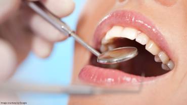 Simple Habits that Can Avoid Damage to Your Teeth