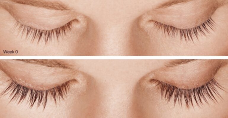Before and after of longer eyelash