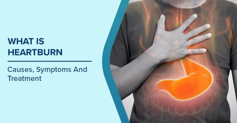 Easy Habits to Avoid Heartburn