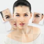 Dealing With Teen Acne Is Now Easy