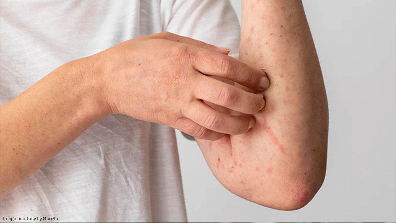 How to reduce risk of cancer - ADC
