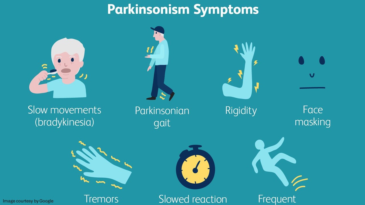 parkinson's disease stages