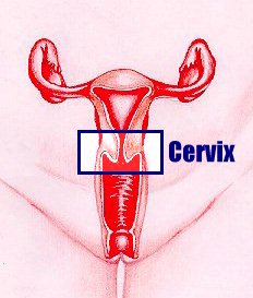 Cervical-Cancer-Symptoms.jpg