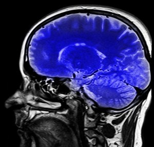 Zemanta Related Posts Thumbnail