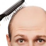 Boons and Banes of Hair Loss Treatments