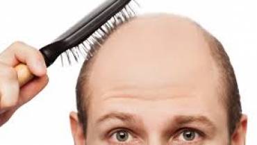 Boons and Banes of Hair Loss Treatments