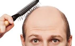 Boons and Banes of Hair Loss Treatments