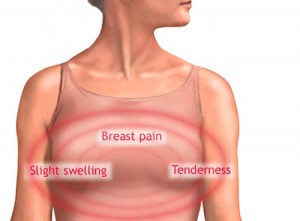risk-of-breast-cancer.jpg