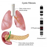 What you need to know about Cystic Fibrosis!