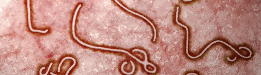 Ebola Virus Signs and Symptoms