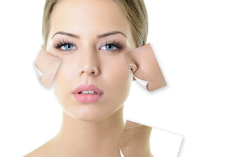 Know About Dry Skin