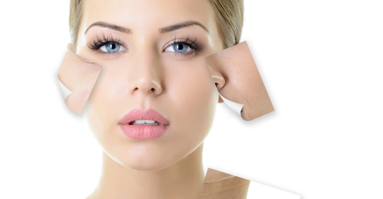 Know About Dry Skin