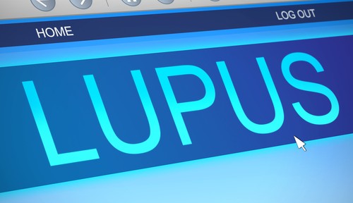 Diagnosing lupus
