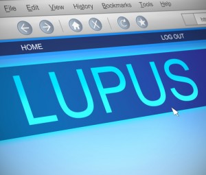 Lupus