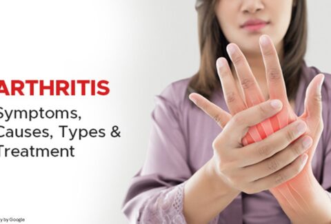 arthritis disease - All Day Chemist