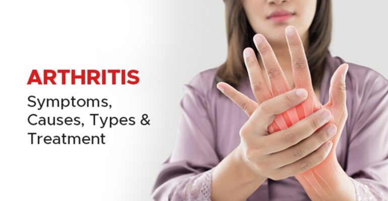 arthritis disease - All Day Chemist
