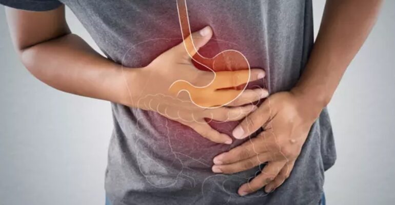 stomach ulcer - ADC