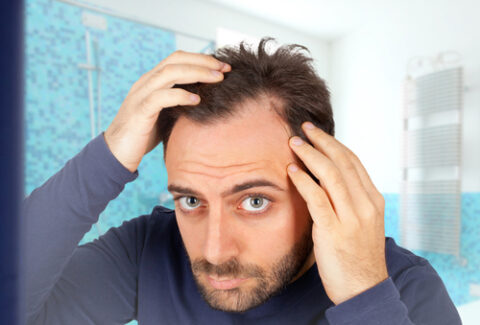Hair loss