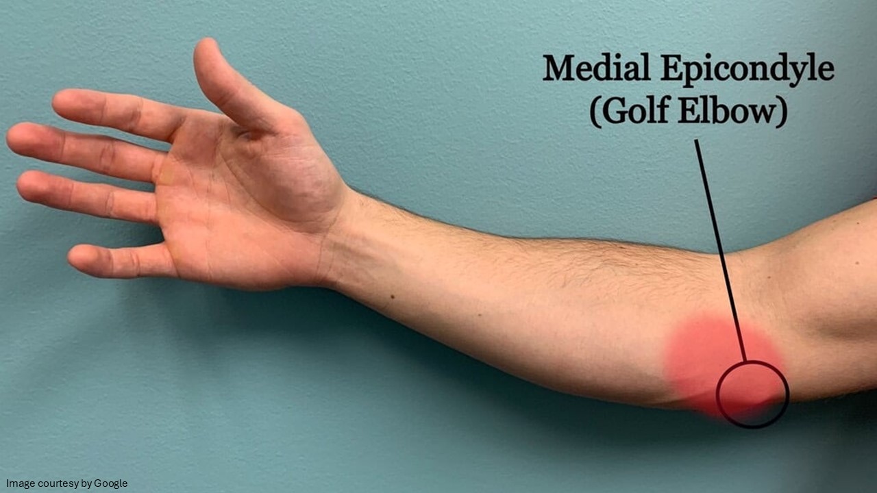 how to treat tennis elbow - ADC