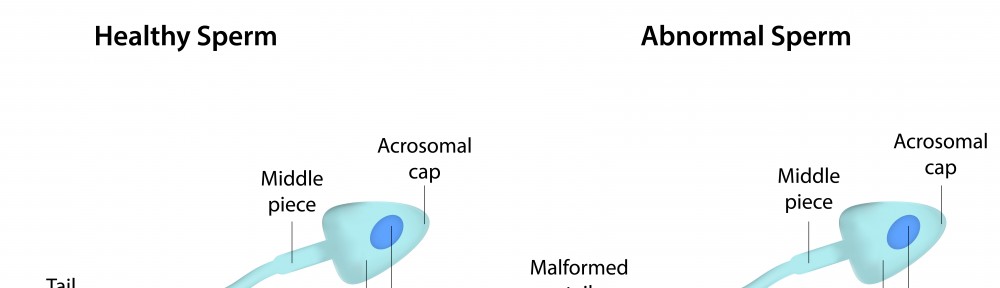 The growing problem of male infertility - AllDayChemist Health Blog