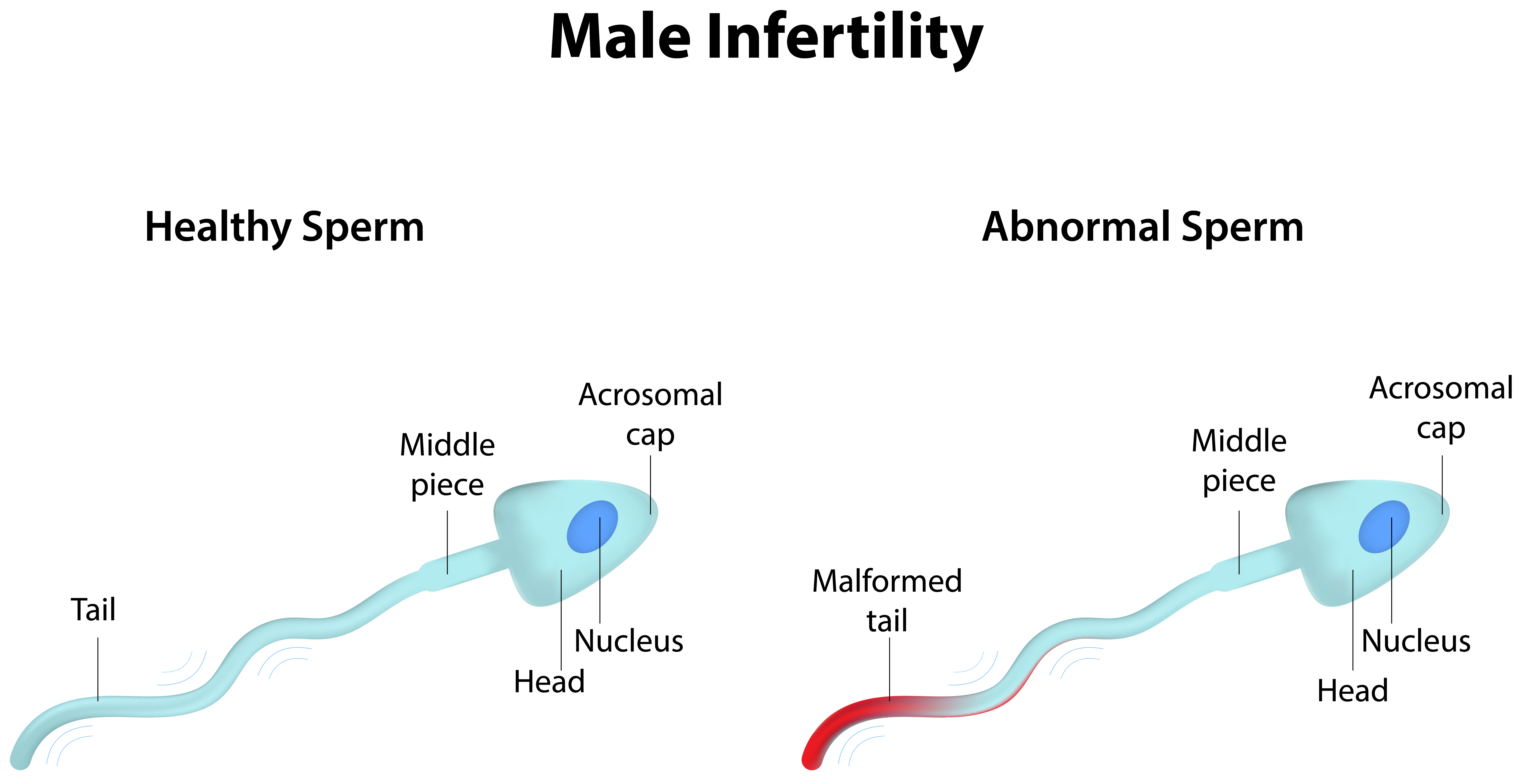 The growing problem of male infertility - AllDayChemist Health Blog
