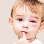 Common and Dangerous Eye Health Risks and Tips to handle them