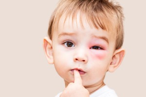 Common and Dangerous Eye Health Risks and Tips to handle them