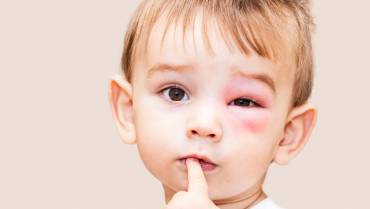 Common and Dangerous Eye Health Risks and Tips to handle them