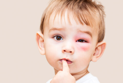 Common and Dangerous Eye Health Risks and Tips to handle them