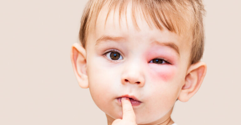 Common and Dangerous Eye Health Risks and Tips to handle them