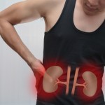 Know about Kidney Stone Prevention