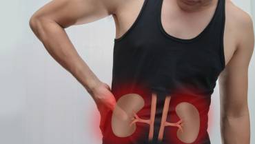 Know about Kidney Stone Prevention