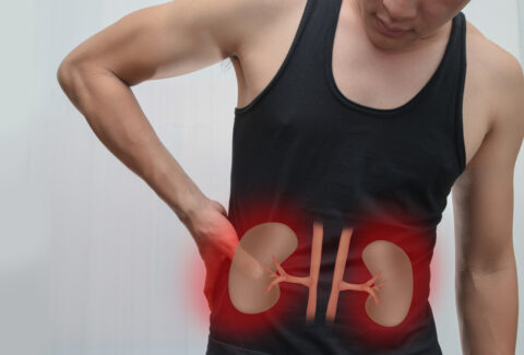Know about Kidney Stone Prevention