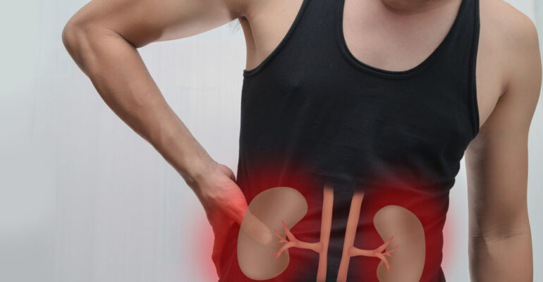 Know about Kidney Stone Prevention