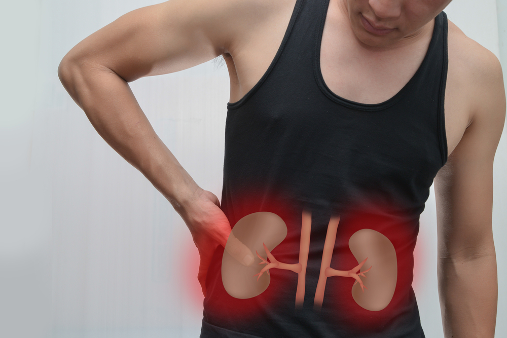 Know about Kidney Stone Prevention