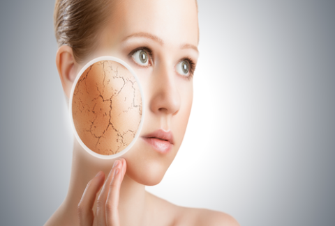 how to get rid of dry skin
