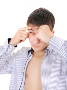 acne in men