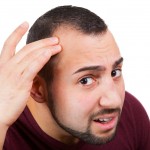 Male Baldness Could Be a Personality Too