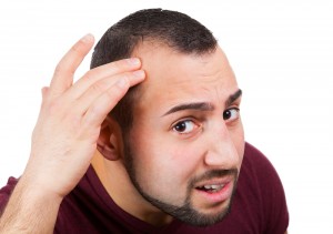 male baldness