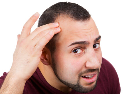 male baldness