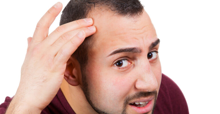 male baldness