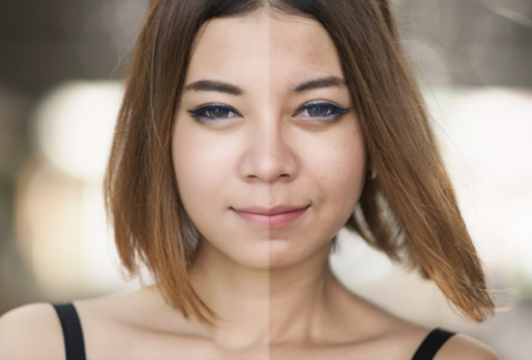 pores on face