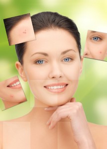 Home remedies for pigmentation